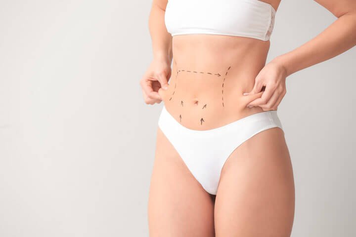 Lipoaspiração